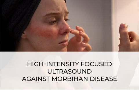 HIGH-INTENSITY FOCUSED ULTRASOUND AGAINST MORBIHAN DISEASE