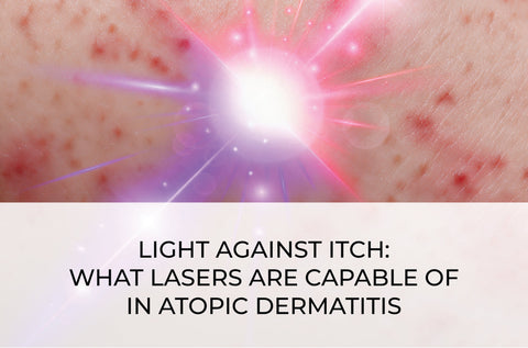 LIGHT AGAINST ITCH: WHAT LASERS ARE CAPABLE OF IN ATOPIC DERMATITIS