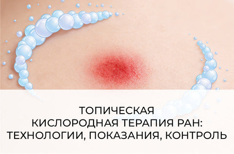 ТОПИЧЕСКАЯ КИСЛОРОДНАЯ ТЕРАПИЯ РАН: ТЕХНОЛОГИИ, ПОКАЗАНИЯ, КОНТРОЛЬ