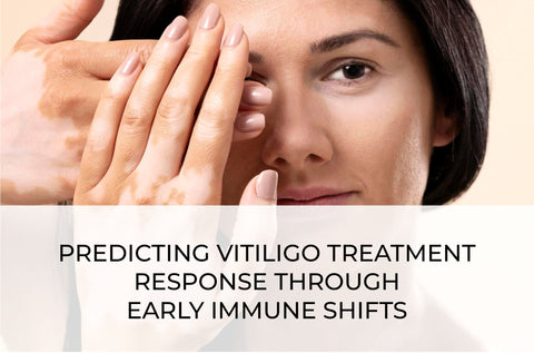 PREDICTING VITILIGO TREATMENT RESPONSE THROUGH EARLY IMMUNE SHIFTS